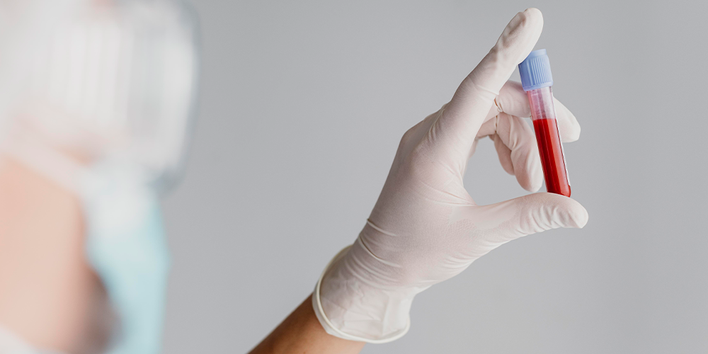 Análisis de Hemoglobina Glicosilada y Control del Colesterol  3
