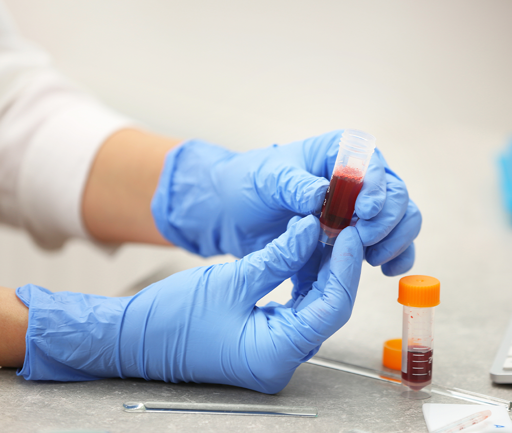 Análisis de Hemoglobina Glicosilada y Control del Colesterol 