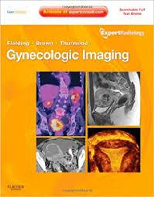 http://axebook.shop/wp-content/uploads/2025/03/gynecologic-imaging-expert-radiology-series-expert-consult-premium-edition-enhanced-online-features-and-print-1e-gynecologic-imaging.jpg