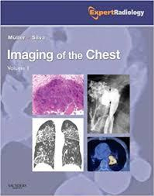http://axebook.shop/wp-content/uploads/2025/03/imaging-of-the-chest-2-volume-set-expert-radiology-series-1e-imaging-of-the-chest-2-volume-set-expert-radiology-series-1e.jpg
