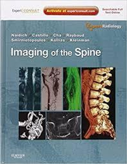 http://axebook.shop/wp-content/uploads/2025/03/imaging-of-the-spine-expert-radiology-series-expert-consult-online-and-print-1e-imaging-of-the-spine-expert-radiology-series-expert-consult-online-and-print-1e.jpg http://axebook.shop/wp-content/uploads/2025/03/imaging-of-the-spine-expert-radiology-series-expert-consult-online-and-print-1e-imaging-of-the-spine-expert-radiology-series-expert-consult-online-and-print-1e.jpg