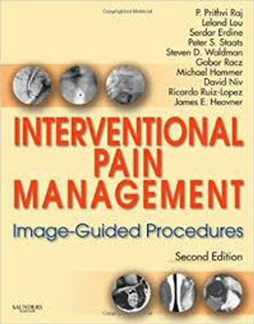 http://axebook.shop/wp-content/uploads/2025/03/interventional-pain-management-image-guided-procedures-interventional-pain-management-image-guided-procedures.jpg
