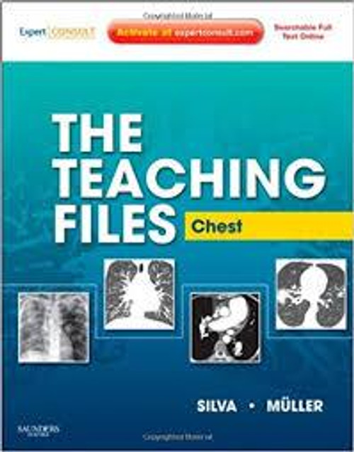 http://axebook.shop/wp-content/uploads/2025/03/the-teaching-files-chest-expert-consult-online-and-print-1e-teaching-files-in-radiology-the-teaching-files-chest-expert-consult-online-and-print-1e-teaching-files-in-radiology.jpg