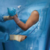 Shoulder Arthroscopy Drape / Beach Chair Drape