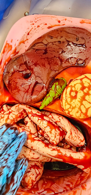 Add our high viscosity Mock Blood for suction practice & a realistic organ feel.