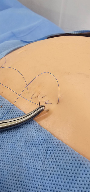 Imbedded Mesh for No Tare Suturing