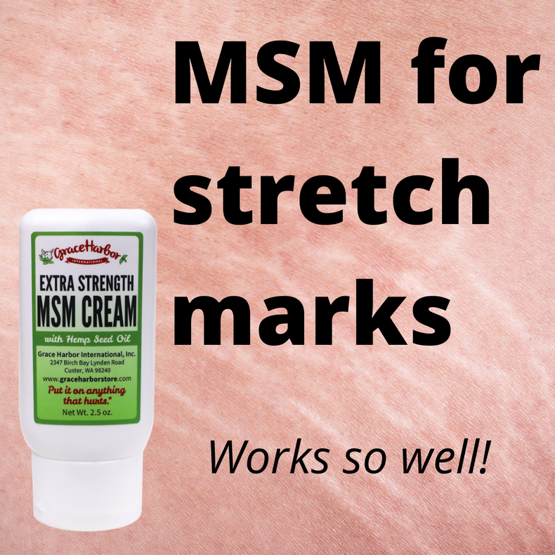 ​Msm cream for stretch marks