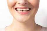 How to cover a broken tooth 