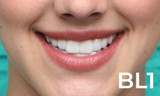How to make your teeth white fast at home