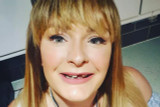 Should Elderly People Opt for Dental Bridge for Missing Teeth