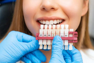 A1 Tooth Shade