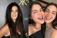 What did Kylie Jenner have done to her teeth?
