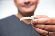 Are there non-surgical dental implants?