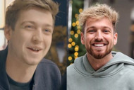 What did Sam Thompson have done to his teeth?