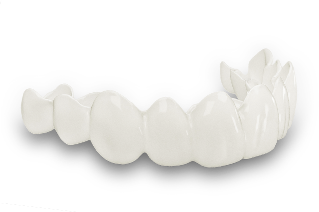 Instasmile - Alternative to clear braces