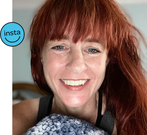instasmile for missing teeth case study