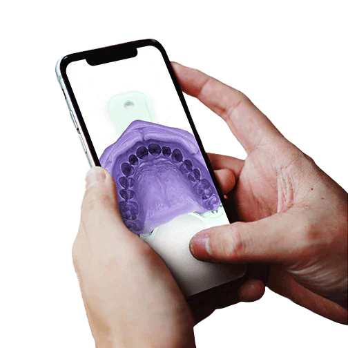 Starts your Perfect Instasmile with a successful self Impression