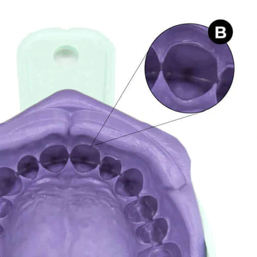 b. impression of where your tooth hits your gu,s