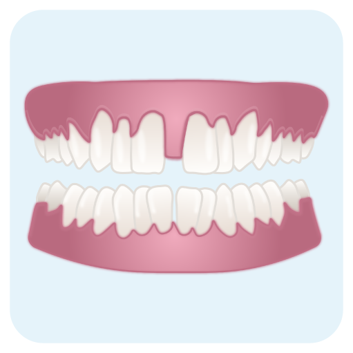 Clip on veneers can help with Gaps Between Teeth