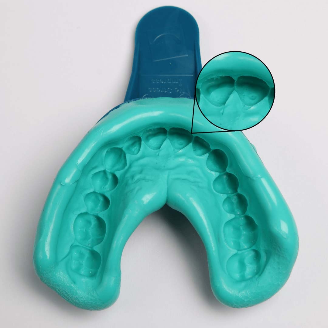 Instasmile guide to using impression kit image B