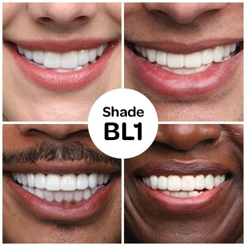 B1 Tooth Shade - instasmile