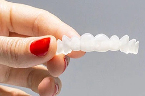 cleaning-clip-on-veneers.jpg