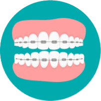 Loose teeth