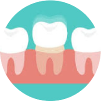 Dental braces