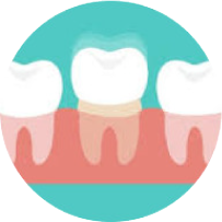 Dental braces