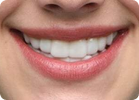A1 shade example