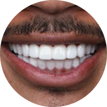 Medium skin veneer user smiling