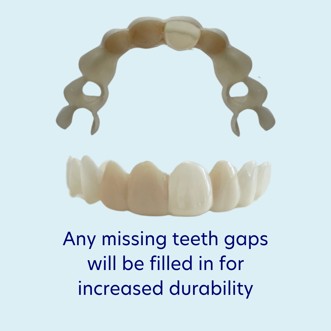 Result example for missing teeth