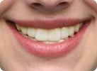 A3 shade example