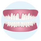 Gaps Between Teeth icon
