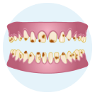Amelogenesis Imperfecta icon