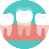 Loose crowns