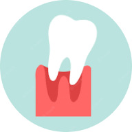 Loose teeth