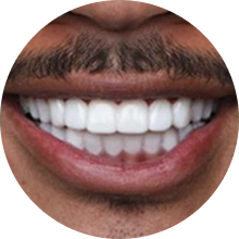 Medium skin veneer user smiling