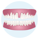 Gaps Between Teeth icon