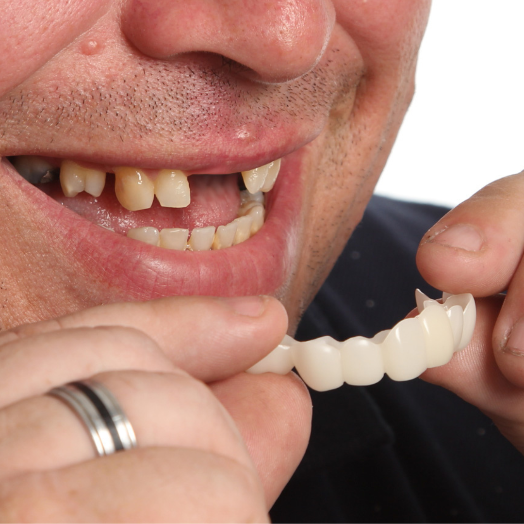 Result example for missing teeth