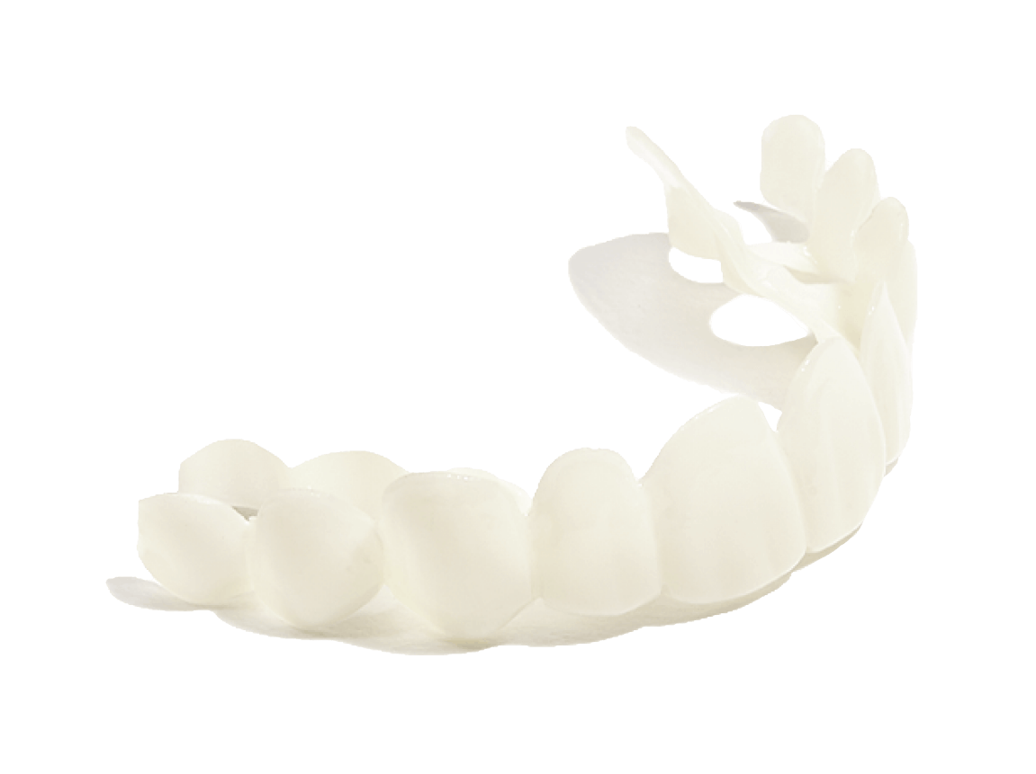 Instasmile Classic example