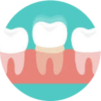 Dental braces