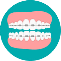 Loose teeth
