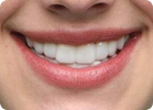 A1 shade example