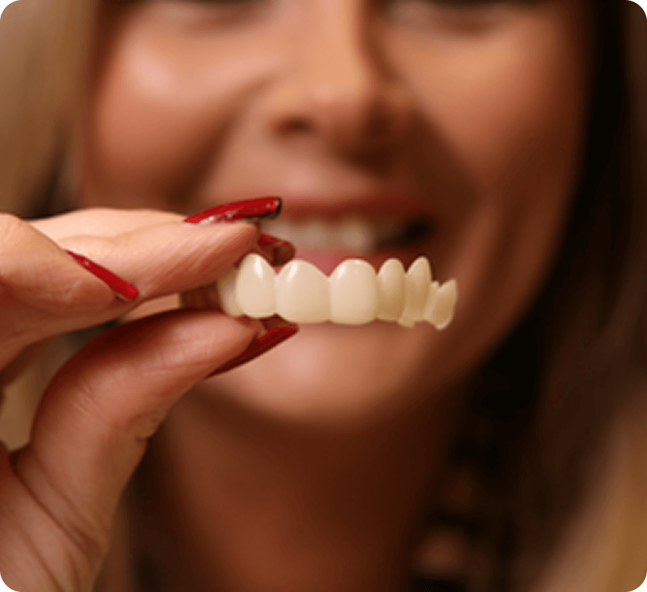 Woman holding Instasmile veneers in front of face.