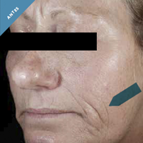 La autoridad antioxidante. Skinceuticals en Farmacia Federico Castillo.