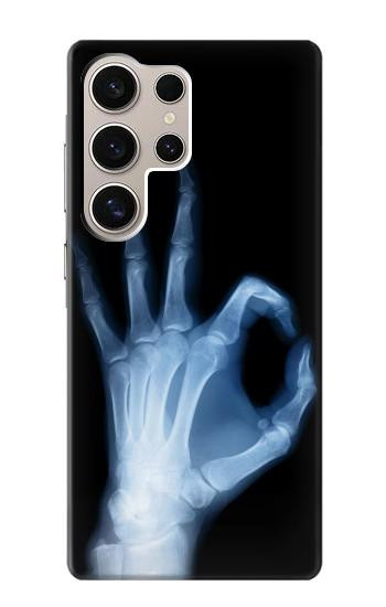 W3239 X-Ray Hand Sign OK Case Cover Custodia e Flip Case per Samsung Galaxy S24 Ultra