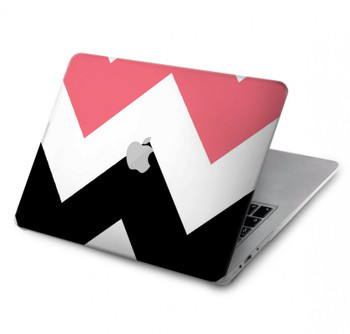 W1849 Pink Black Chevron Zigzag Case Cover Custodia per MacBook Pro 13″ - A1706, A1708, A1989, A2159, A2289, A2251, A2338