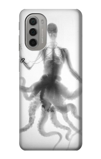 W1432 Skull Octopus X-ray Case Cover Custodia e Flip Case per Motorola Moto G51 5G W1432 Skull Octopus X-ray Case Cover Custodia e Flip Case per Motorola Moto G51 5G