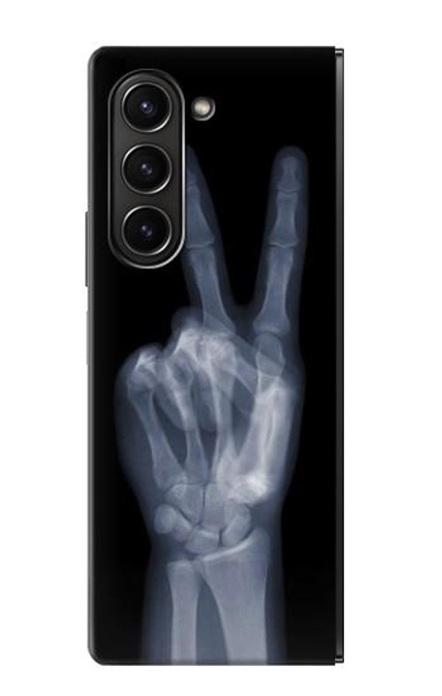 W3101 X-ray Peace Sign Fingers Case Cover Custodia e Flip Case per Samsung Galaxy Z Fold 5